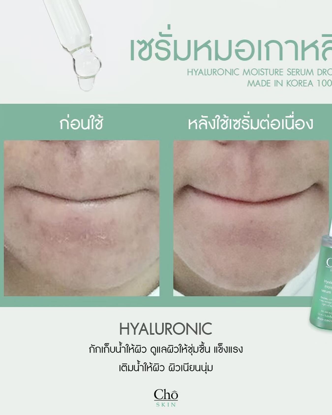 เนย - โชติกา วงศ์วิลาศ