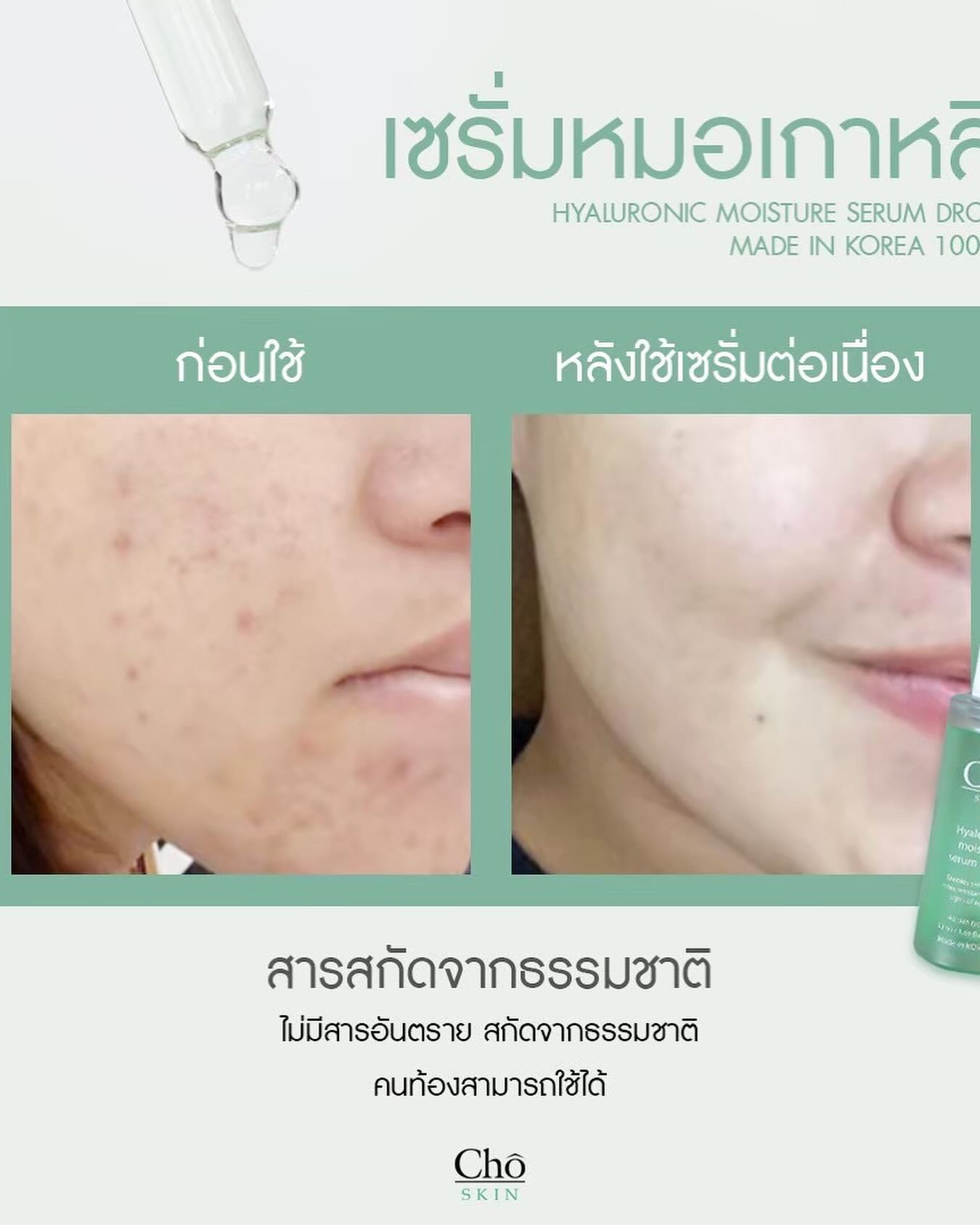 เนย - โชติกา วงศ์วิลาศ