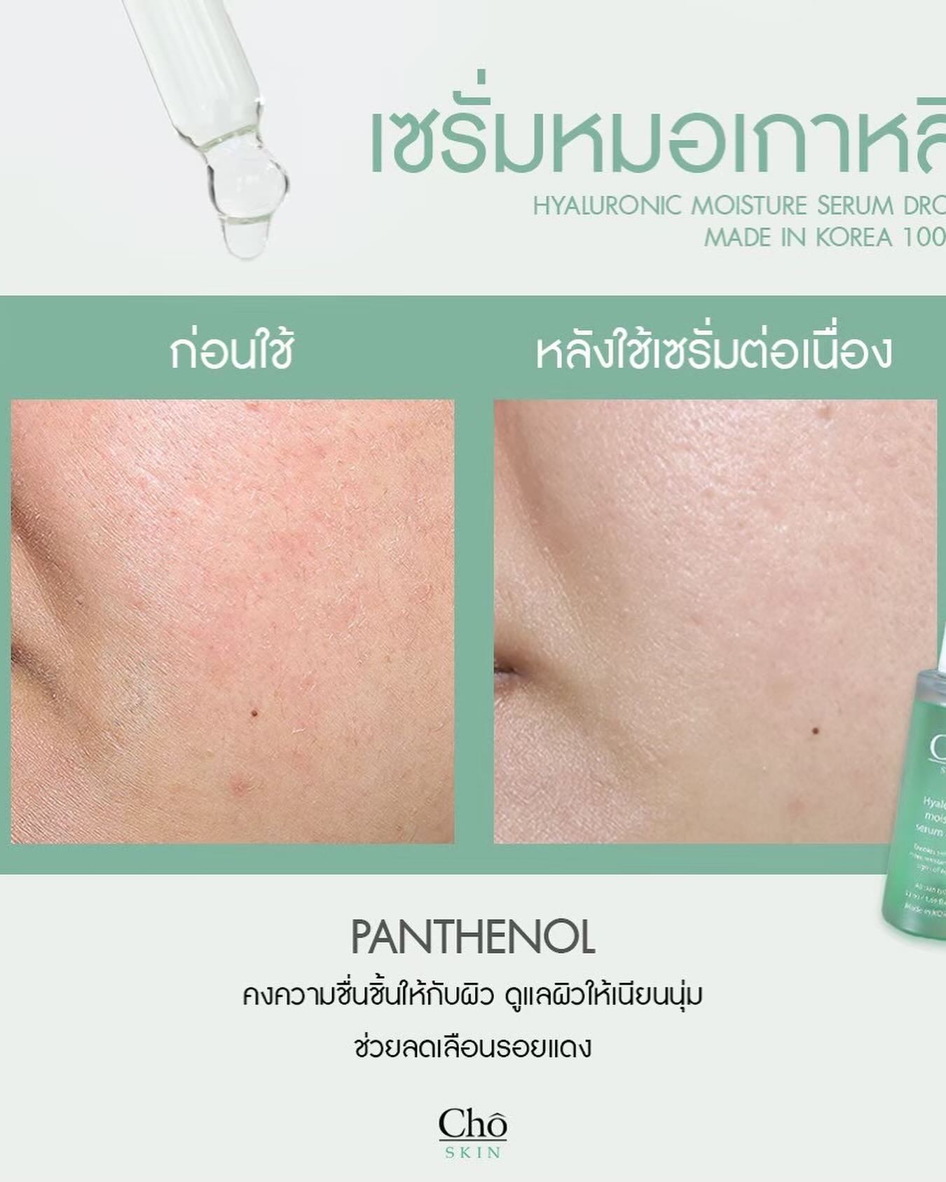 เนย - โชติกา วงศ์วิลาศ