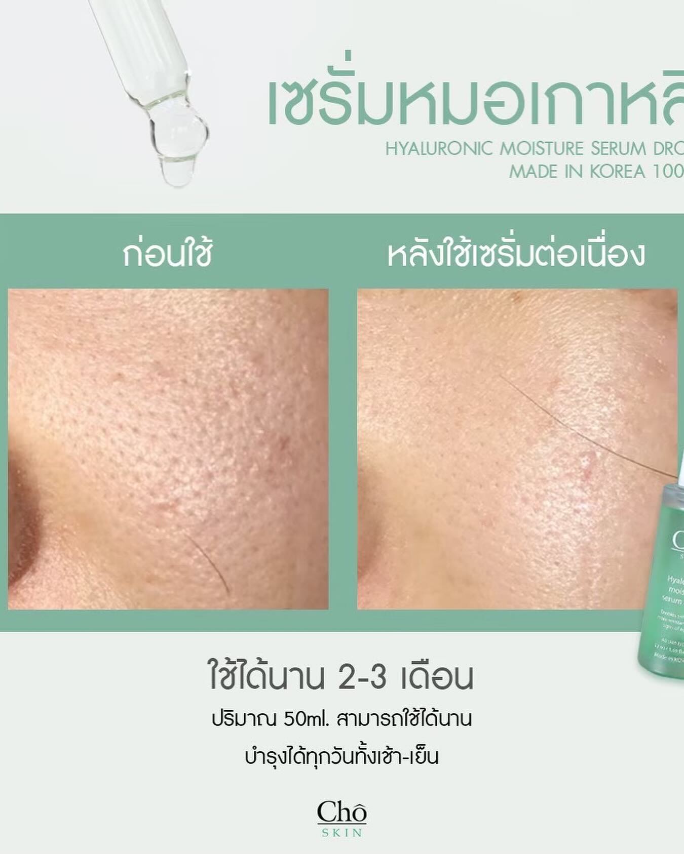 เนย - โชติกา วงศ์วิลาศ