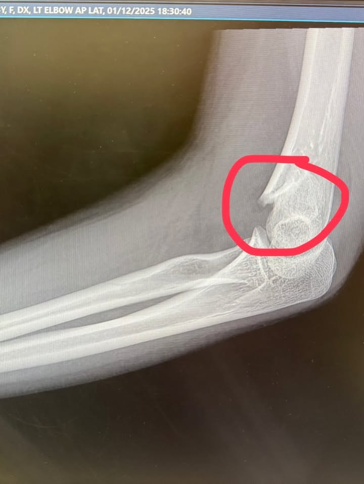 อินเตอร์ - รุ่งรดา รุ่งลิขิตเจริญ