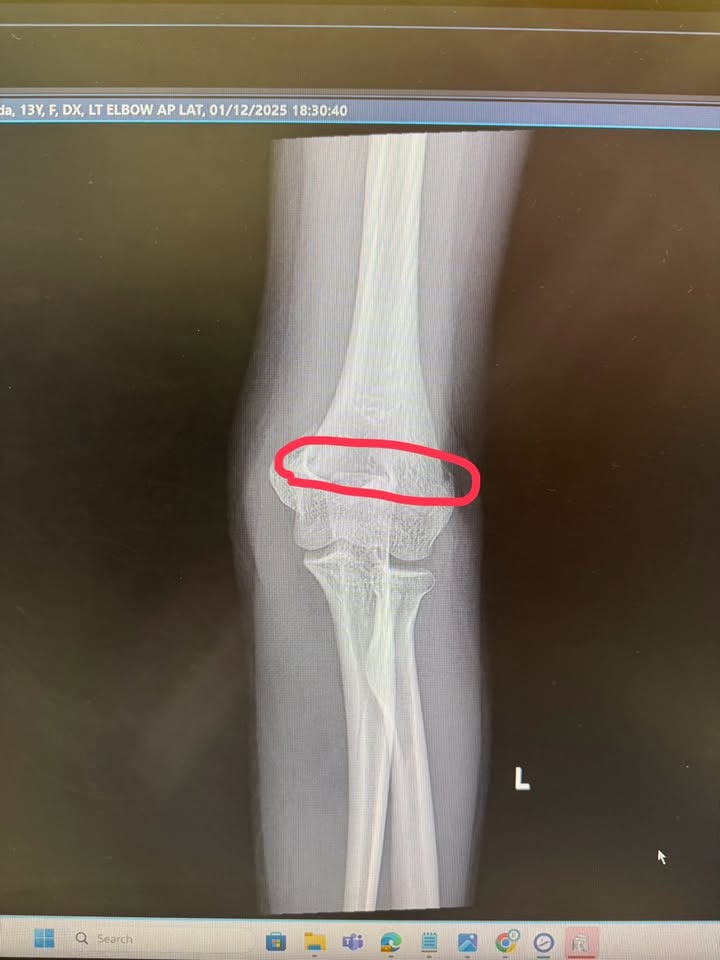 อินเตอร์ - รุ่งรดา รุ่งลิขิตเจริญ
