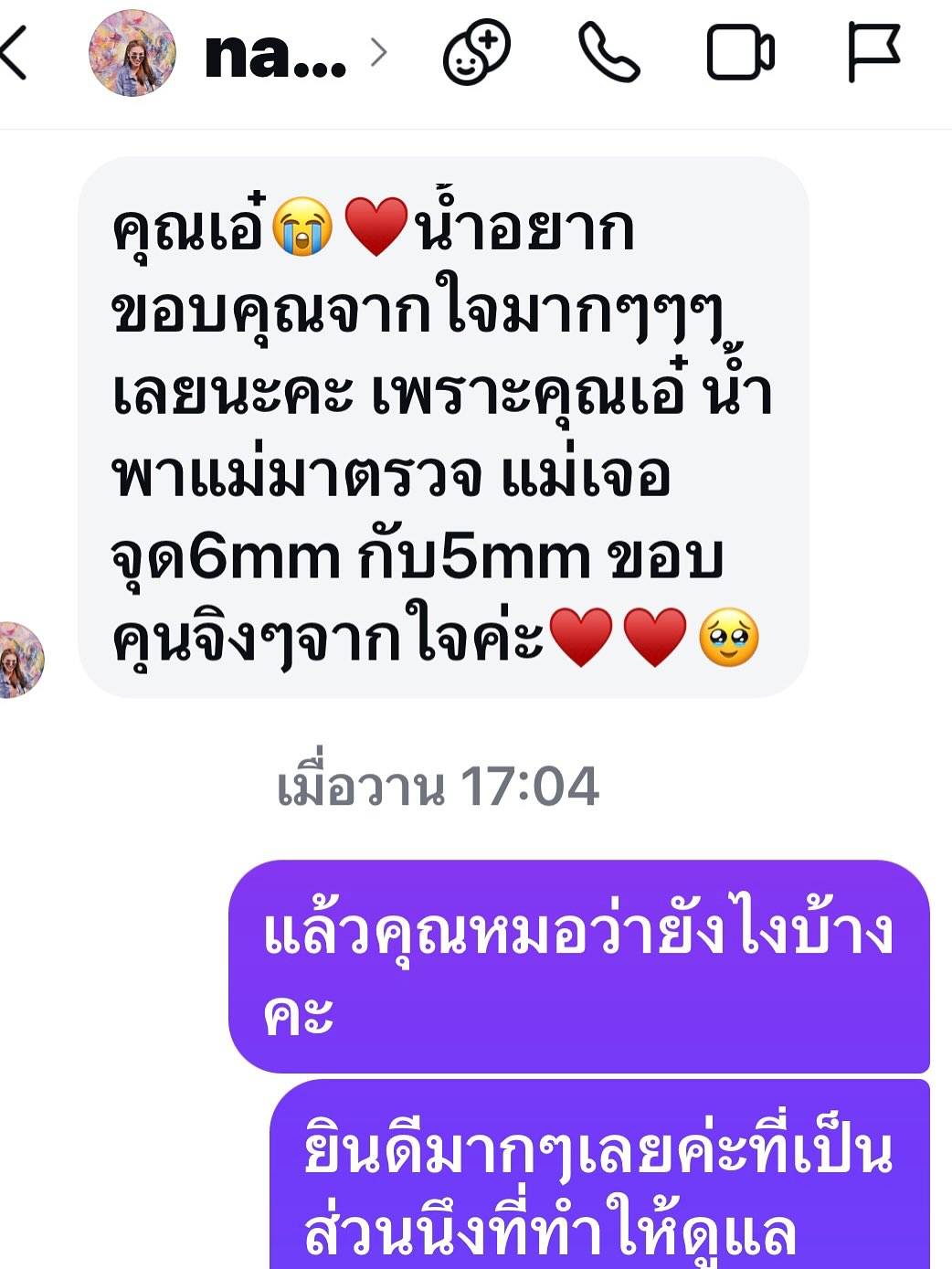 เอ๋ - พรทิพย์ สกิดใจ
