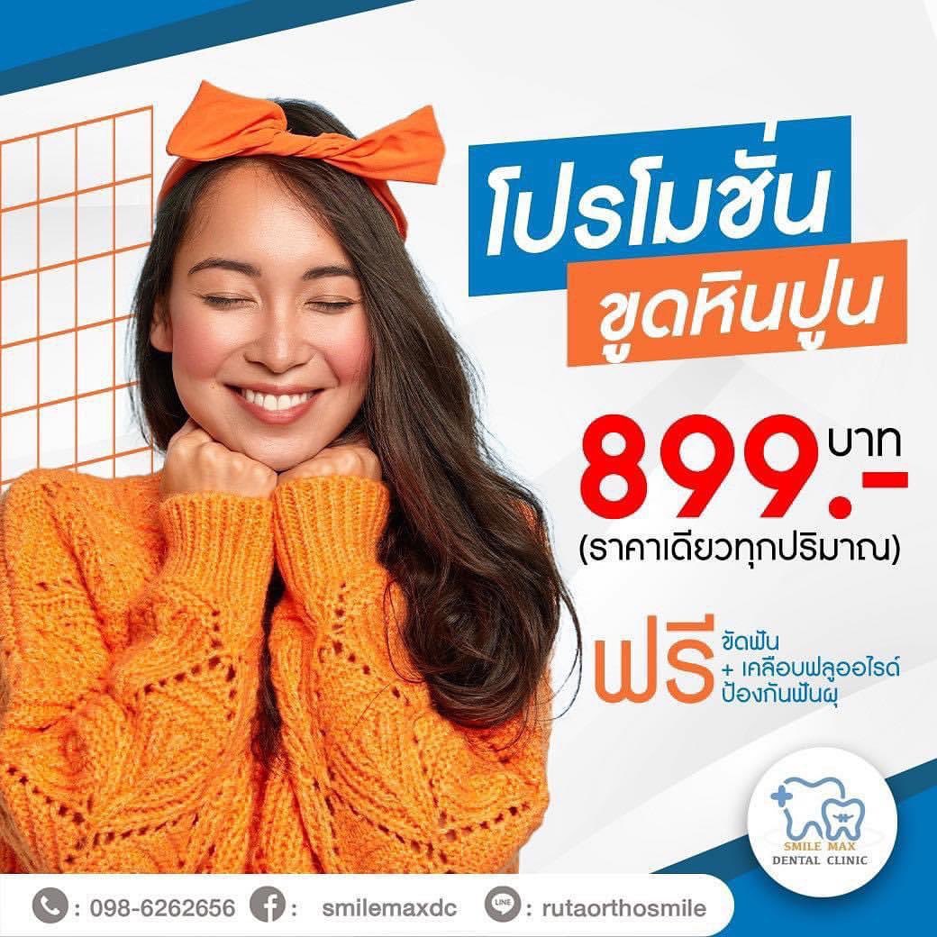 ดิว - อรุณพงศ์ ชัยวินิตย์