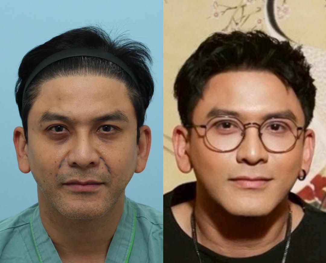 ป๋อ - ณัฐวุฒิ สกิดใจ