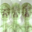 อัลบัม Supergrass